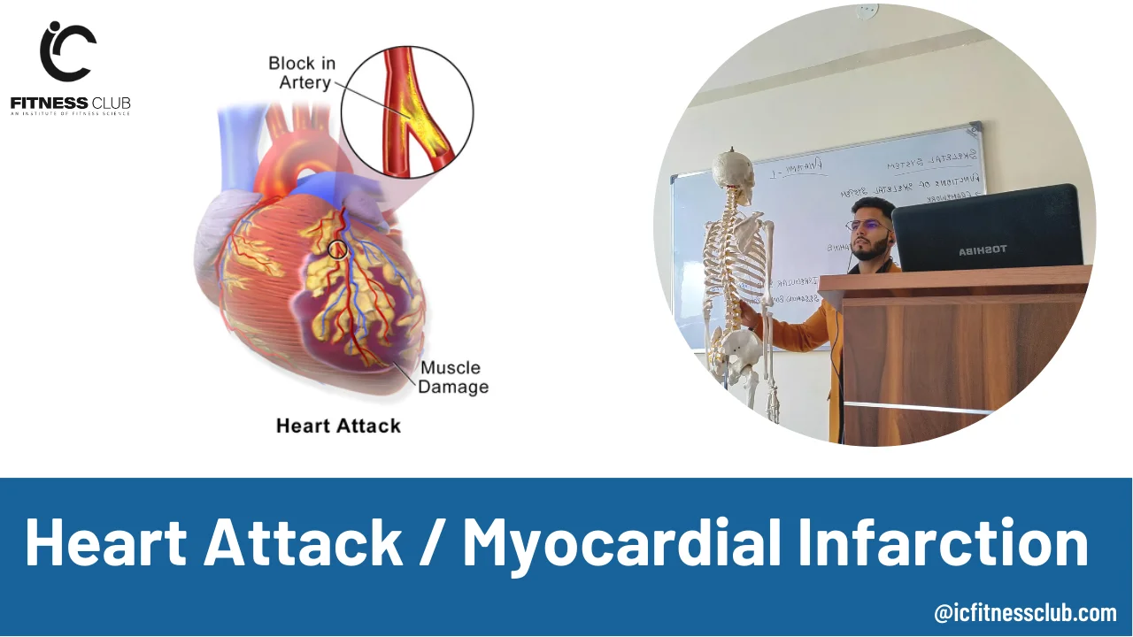 Heart-Attack | Myocardial Infarction